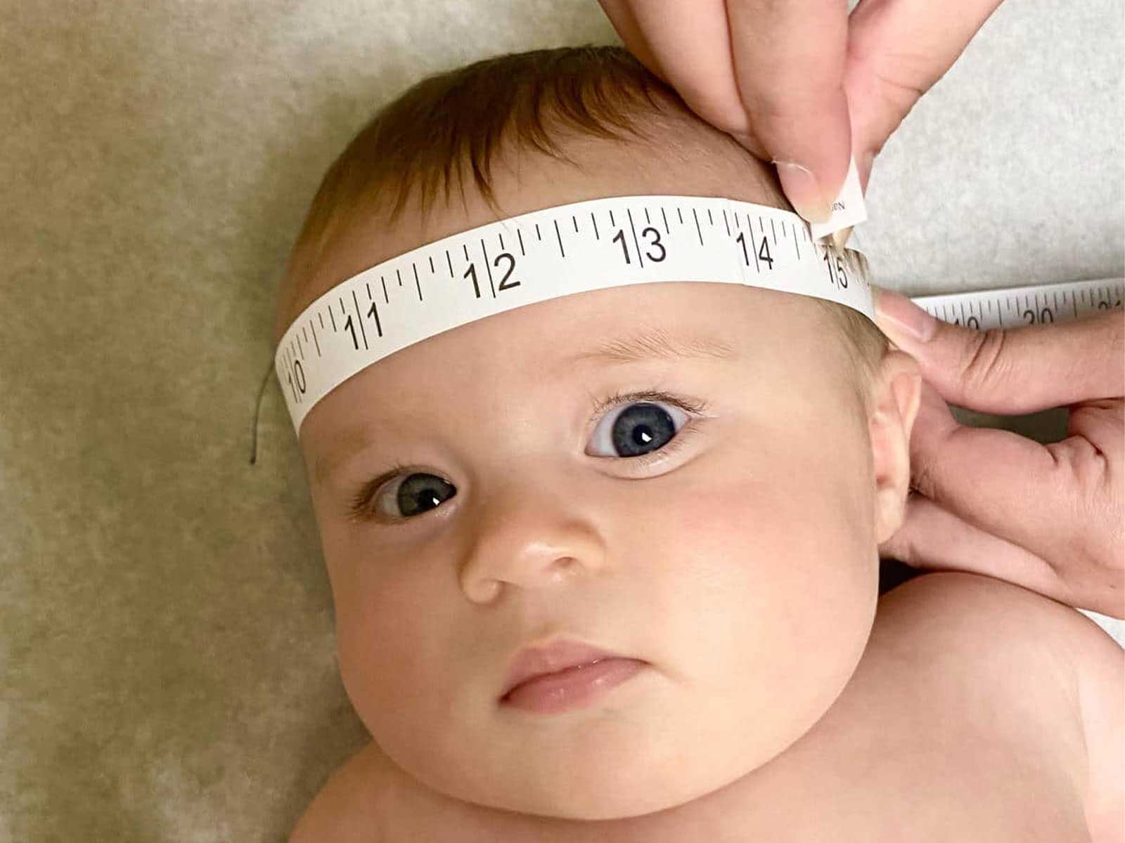 Why My Baby’s Wearing a Helmet These Days Jasmine Roth